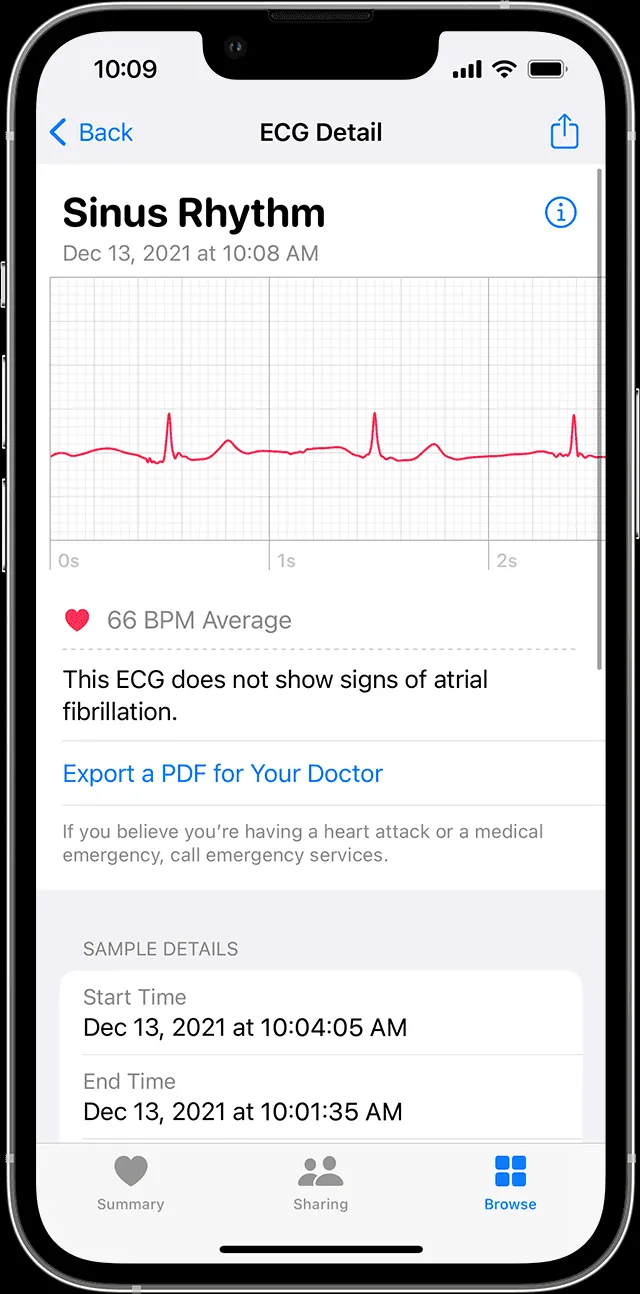Xem lại kết quả ECG và tóm tắt trong ứng dụng Sức khỏe trên iPhone
